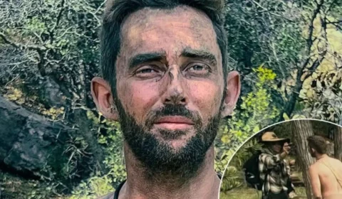 Homem queima pênis em reality