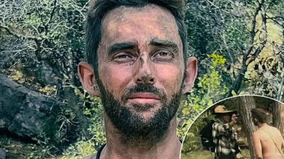 Homem queima pênis em reality