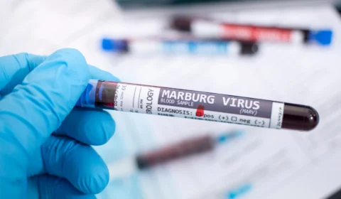 OMS confirma primeiro caso de um dos vírus mais letais do mundo