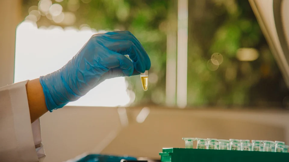 No Amazonas, pesquisa analisa condição genética em pacientes para tratamento eficaz da malária