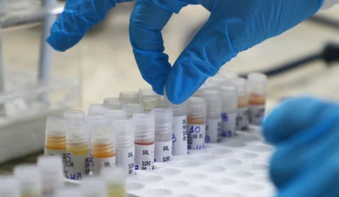 Mpox: Nova atualização não tem registro de caso confirmados da doença no Amazonas