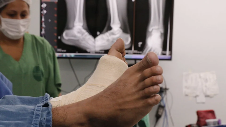 Saúde do Amazonas reforça medidas de prevenção sobre traumas ortopédicos