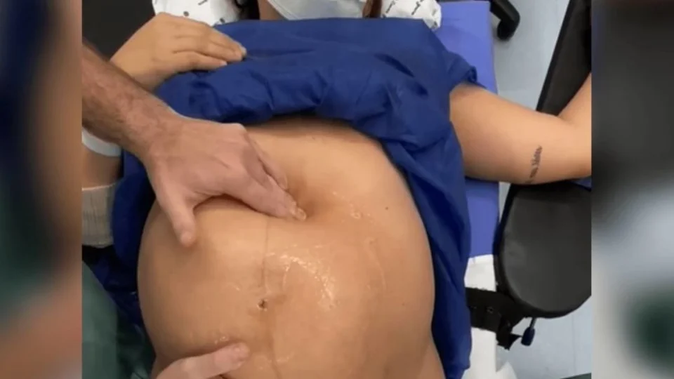 VÍDEO: médico viraliza após virar bebê na barriga da mãe antes do parto
