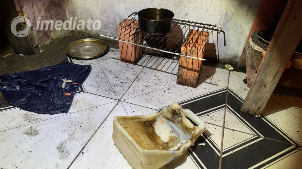 Mãe e filho de 2 anos sofrem queimaduras de 3° grau ao fazer comida usando gasolina