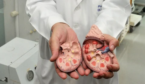 Pedra no rim: Saúde orienta como prevenir e tratar a doença