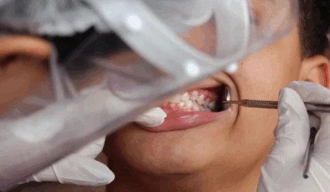 Brasil Sorridente terá 25 equipes e sete laboratórios no Amazonas