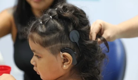 Novos pacientes são beneficiados com implante coclear na rede pública de Saúde do Amazonas