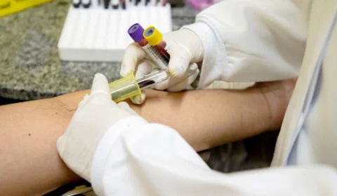 Saiba onde fazer novo teste para diagnosticar tuberculose latente em Manaus