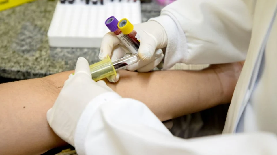 Saiba onde fazer novo teste para diagnosticar tuberculose latente em Manaus