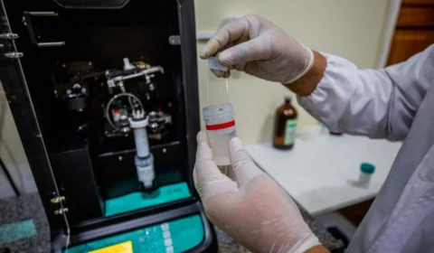 Coleta de exame preventivo em meio líquido será ofertada em Manaus; entenda