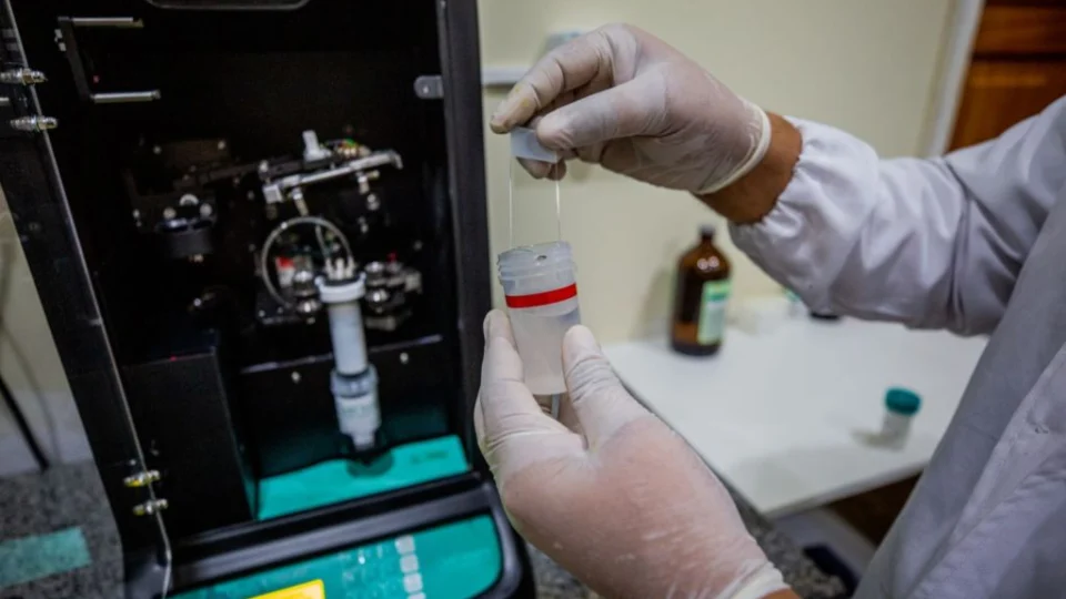 Coleta de exame preventivo em meio líquido será ofertada em Manaus; entenda