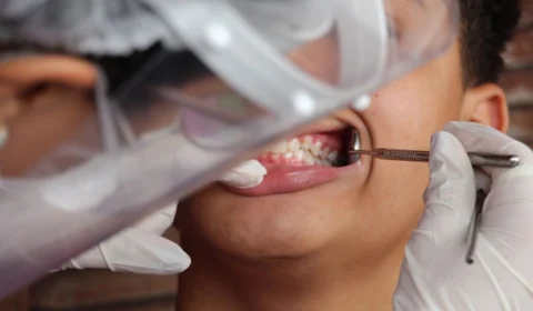 Programa Brasil Sorridente será relançado nesta segunda