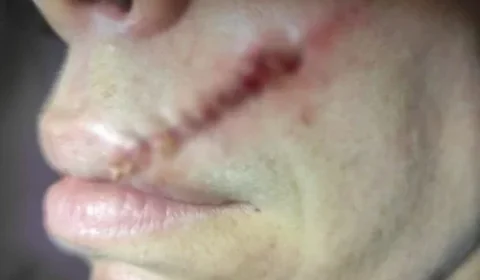 CHOCANTE: Dentista leva pedrada na boca após negar dinheiro a morador de rua