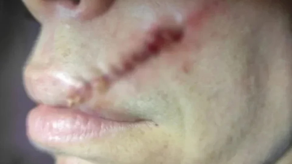 CHOCANTE: Dentista leva pedrada na boca após negar dinheiro a morador de rua