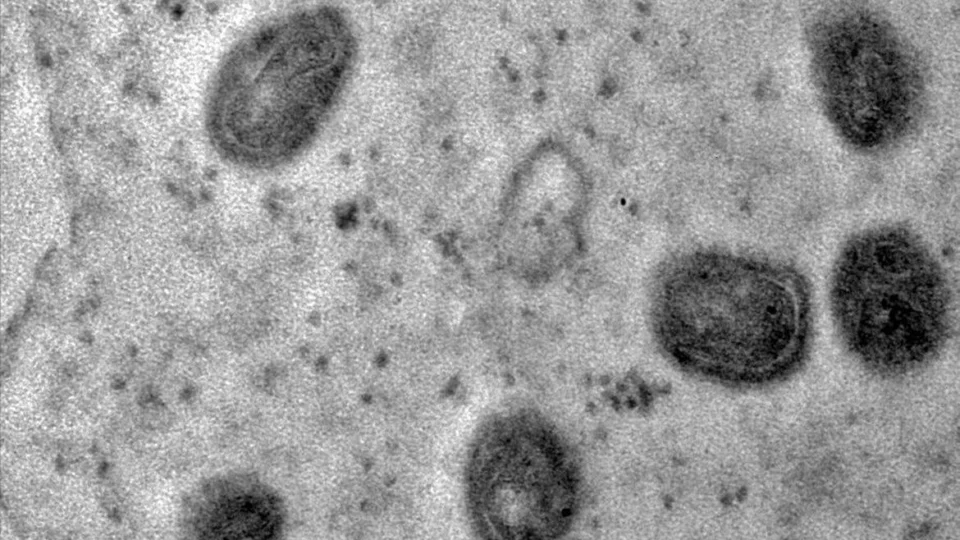 OMS declara fim da emergência em saúde por varíola dos macacos