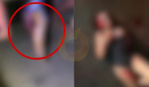 Vídeo: motociclista fica sem braço e jovem perde parte da perna ao colidirem contra caminhão