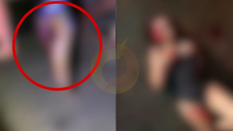 Vídeo: motociclista fica sem braço e jovem perde parte da perna ao colidirem contra caminhão