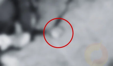 CENAS FORTES: Mulher é esmagada por caminhão e coração fica pulando na pista