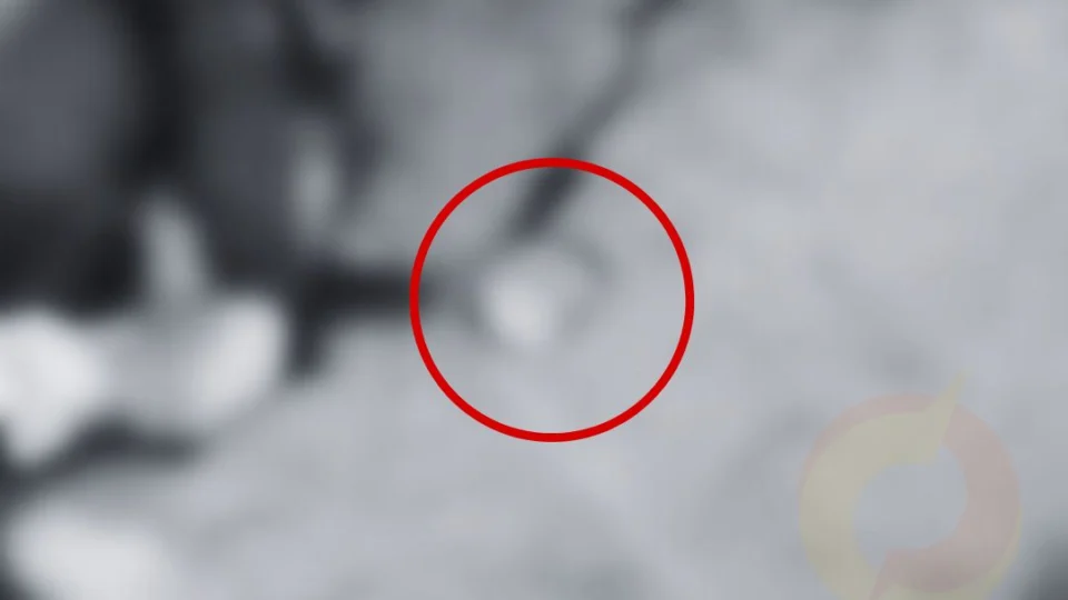 CENAS FORTES: Mulher é esmagada por caminhão e coração fica pulando na pista