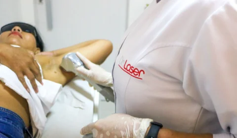 Especialista orienta o método ideal para eliminação dos pelos