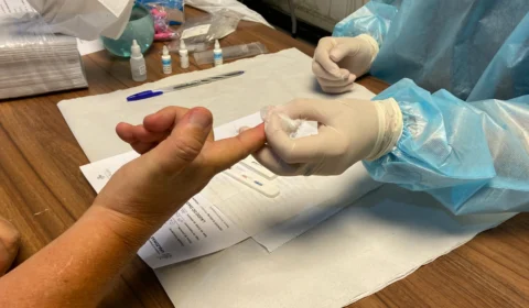 Campanha Julho Amarelo reforça o combate às hepatites virais no Amazonas