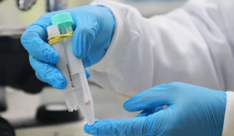 Mpox: Informe atualiza situação da doença e tem periodicidade mensal no Amazonas