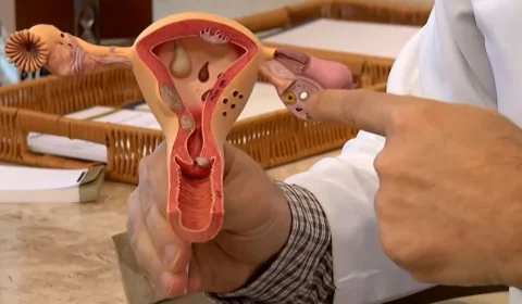 Julho Verde-Escuro conscientiza sobre prevenção ao câncer ginecológico