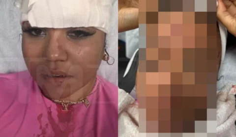Mulher tem cortes na cabeça após ser atingida pelo microfone arremessado por cantor de rap; veja
