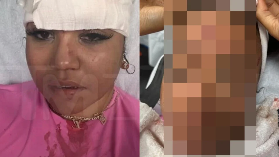 Mulher tem cortes na cabeça após ser atingida pelo microfone arremessado por cantor de rap; veja