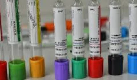 Pesquisadores acreditam que análise do sangue menstrual pode oferecer informações relevantes sobre a saúde