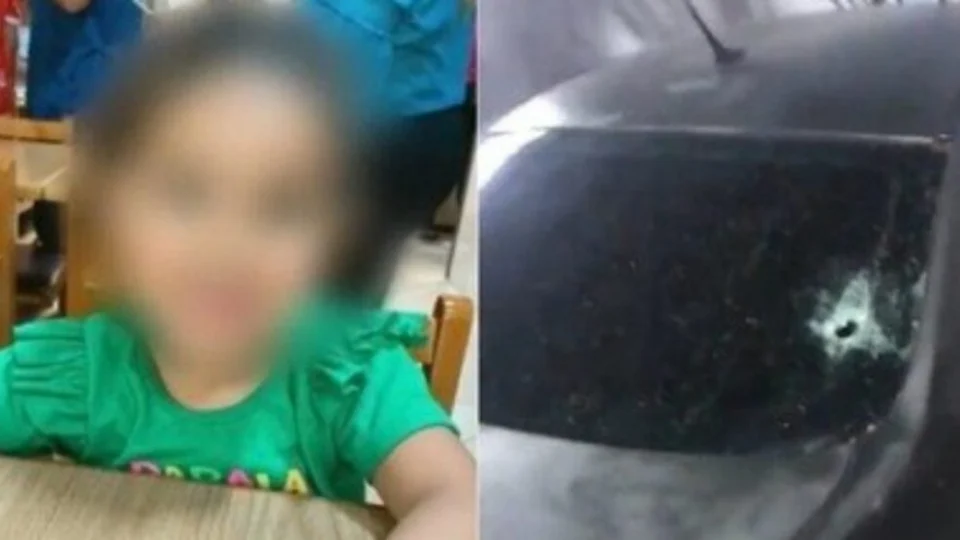 Criança de 3 anos é baleada na cabeça dentro do carro da família