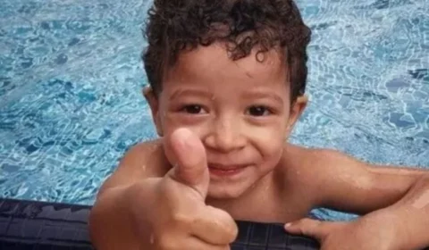 Mangueira de combustível explode na oficina e queima rosto de menino de 3 anos