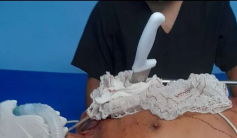 Pescador é achado morto com faca cravada no peito