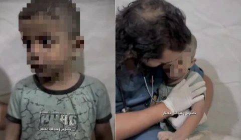 VÍDEO: Em meio ao pânico, médico conforta criança em hospital de Gaza com abraço tocante