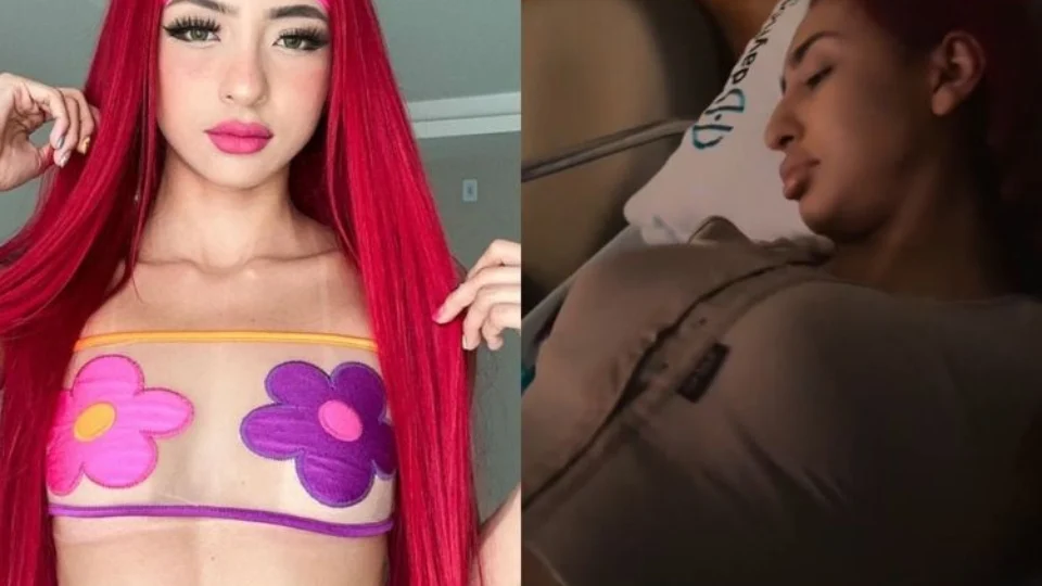 Ruivinha de marte coloca silicone e compartilha antes e depois