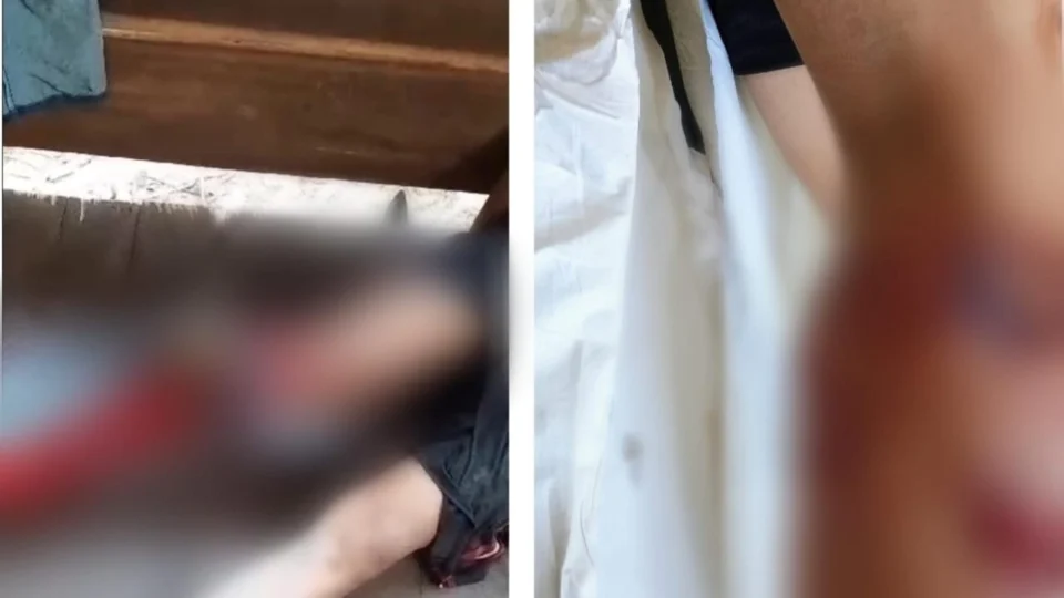 VEJA VÍDEO: jacaré ataca e quase arranca perna de homem no interior do Amazonas