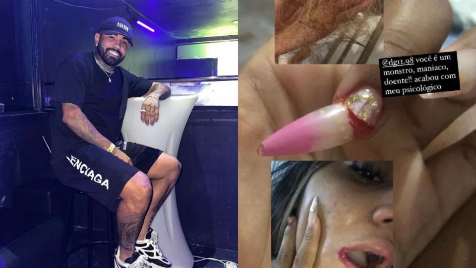 DG, ex-jogador do Amazonas FC, é acusado de agredir mulher durante festa