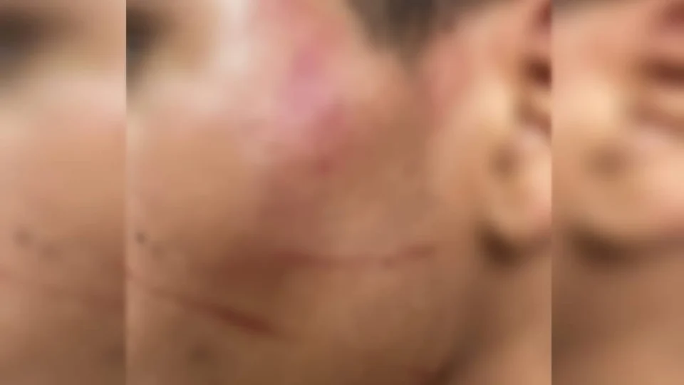 Pai tortura filhos com golpes de facão: “Sou viúvo, preciso educá-los”