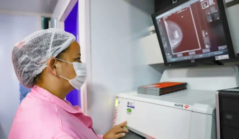 Unidade Móvel de Saúde da Mulher atende em novo endereço em Manaus