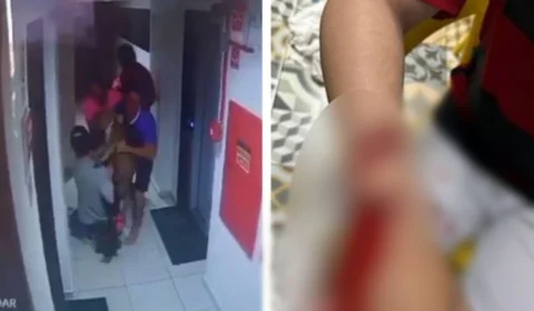 VEJA VÍDEO: pitbull escapa de apartamento e ataca criança em condomínio