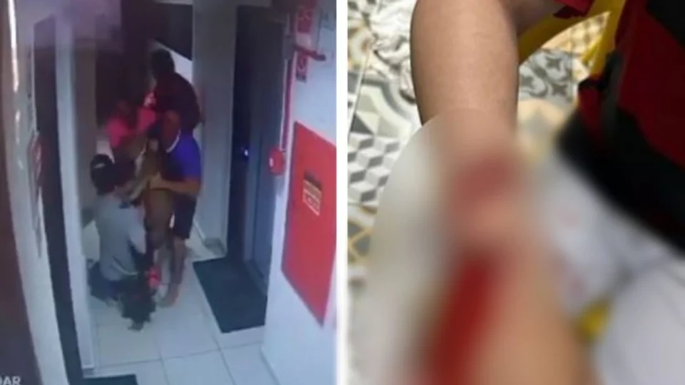 VEJA VÍDEO: pitbull escapa de apartamento e ataca criança em condomínio