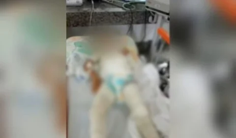 Menino é atingido por fogo quando brincava e tem 40% do corpo queimado