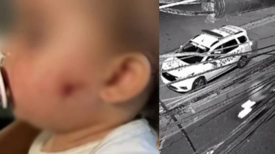 PMs investigados pelo disparo de airsoft que atingiu criança são afastados