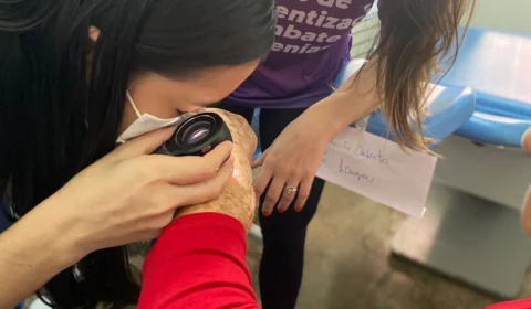Manaus recebe ações para pacientes com suspeita de câncer de pele neste sábado