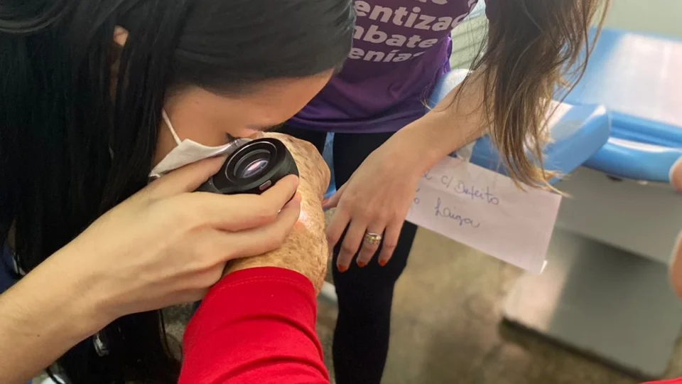 Manaus recebe ações para pacientes com suspeita de câncer de pele neste sábado