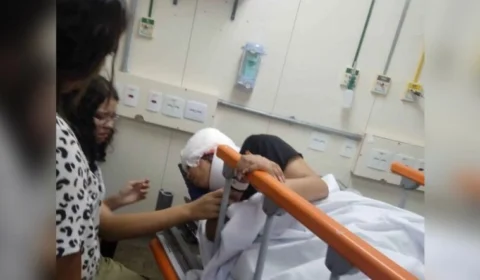 Adolescente perde 80% do couro cabeludo após cabelo engatar em motor de kart em corrida no DF