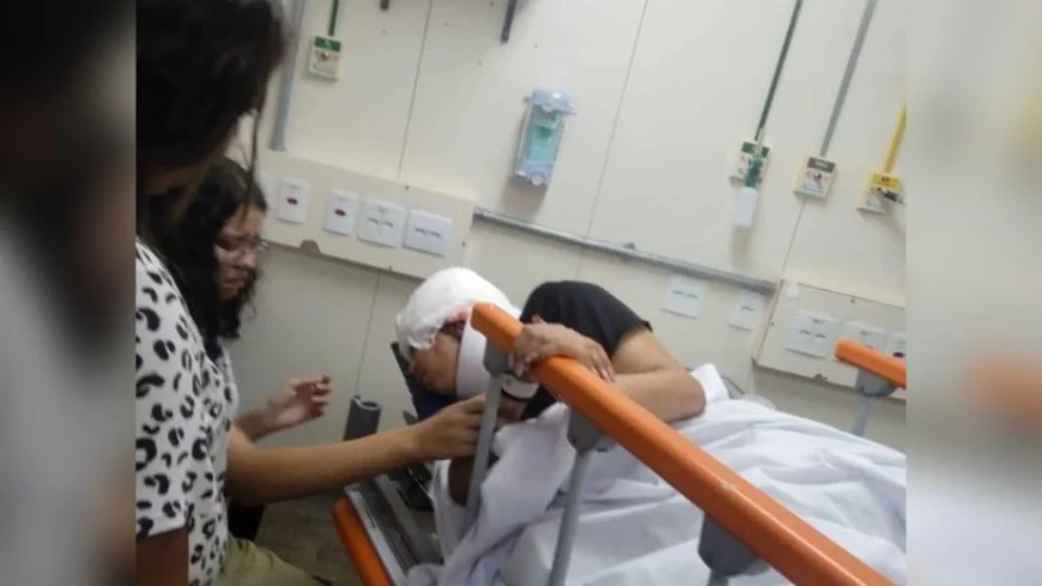 Adolescente perde 80% do couro cabeludo após cabelo engatar em motor de kart em corrida no DF