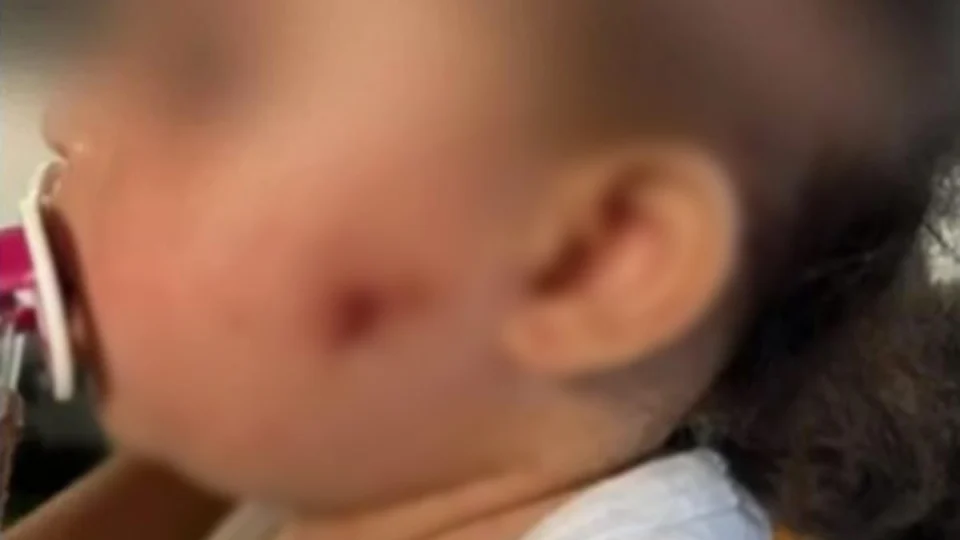 PM atira em bebê de um ano com arma de airsoft; criança está internada