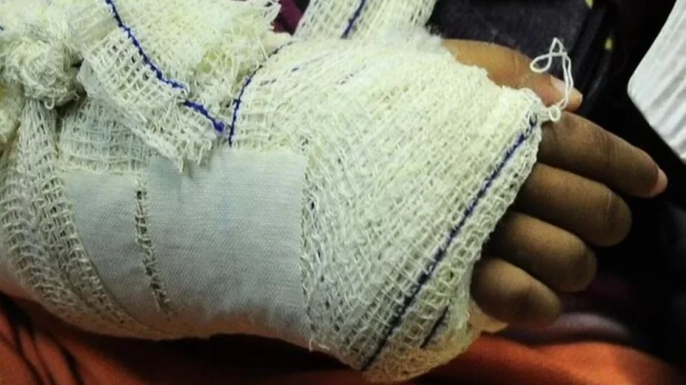 Homem dá cadeirada na filha, bate na esposa e tenta atropelá-las