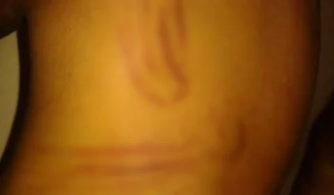 Homem é preso suspeito de chicotear grávida e tentar estrangular a mãe